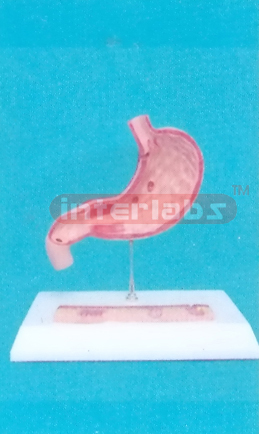 HUMAN ULCER STOMACH MODEL